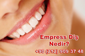 Empress Diş Nedir