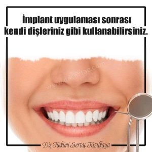 İmplant diş fiyatı 2020