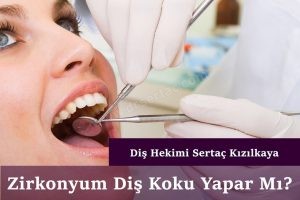 Diş kaplama sorunları koku, kanama, çekilme. Zirkonyum ve porselen diş kaplamalar