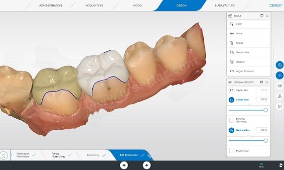 cerec yapımı