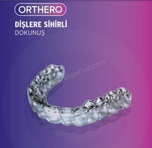 Orthero ile telsiz şeffaf plak tedavisi fiyatı Ne Kadar?